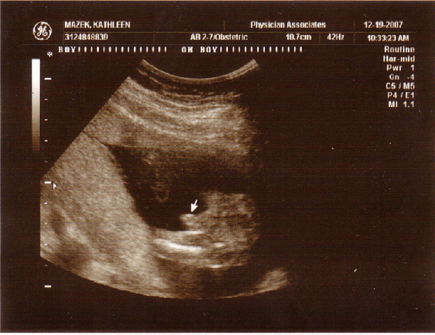 Boy Scan